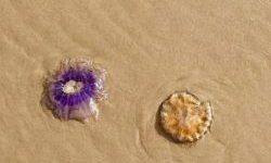 Hypnose – und wie sie mir half!